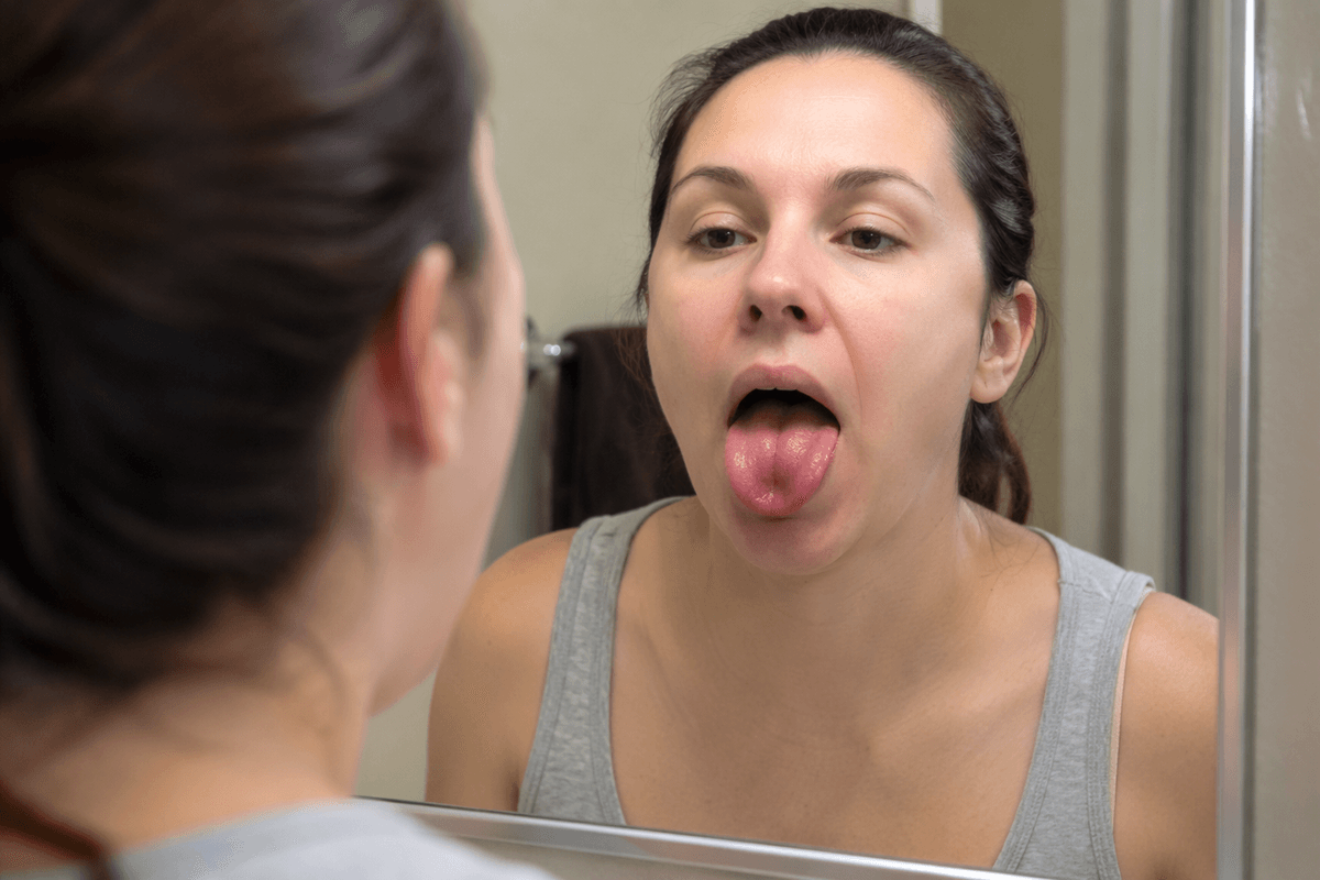 Tongue redness, swelling, and a “smooth” surface